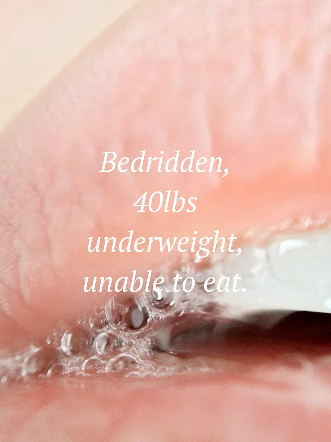 Lips close-up with the quote: Bedridden, 40lbs underweight, unable to eat.